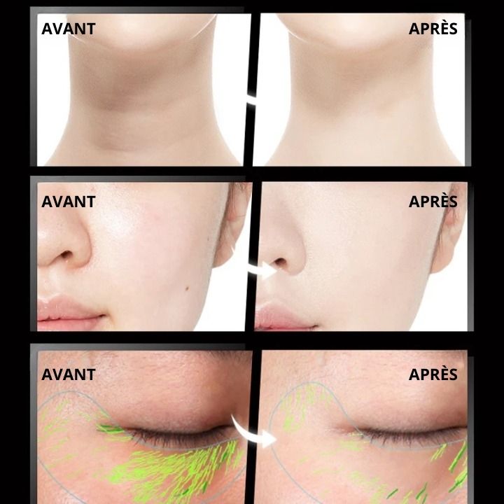 LIFTEUR VISAGE ANTI RIDES/TACHES💎 - Discoveri